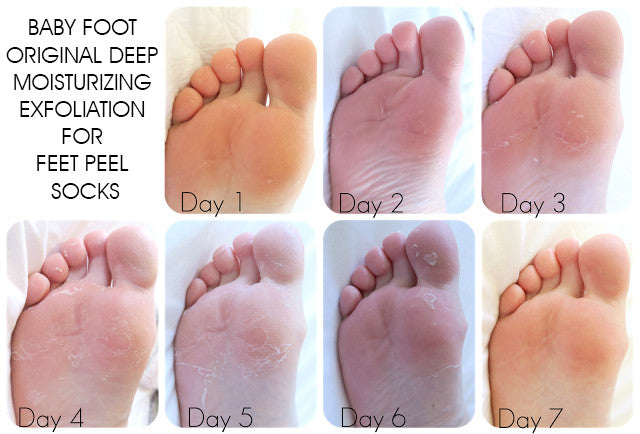 Baby Foot Original Deep Moisturizing Exfoliation for Feet Peel Socks - women beauty - 99fab.com